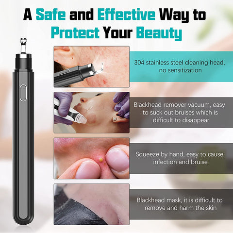 Blackhead Remover With 30X Camera, Electric Device For Removing Nasal And Facial Acne